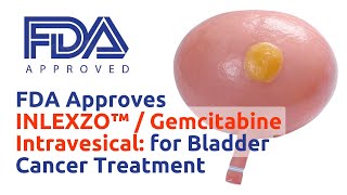 FDA Approves INLEXZO™ / Gemcitabine Intravesical Bladder Cancer Breakthrough (2025)