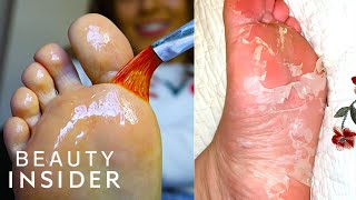 How A Chemical Peel Exfoliates Your Feet | Beauty Explorers