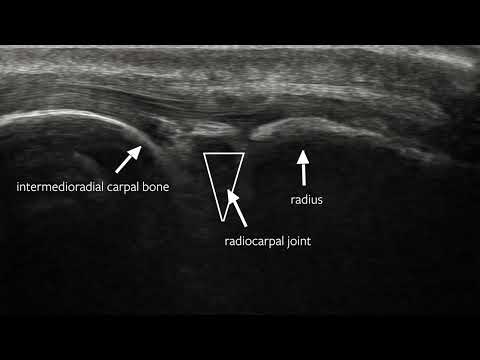Ultrasound-Guided Joint Injections and Arthrocentesis in Dogs