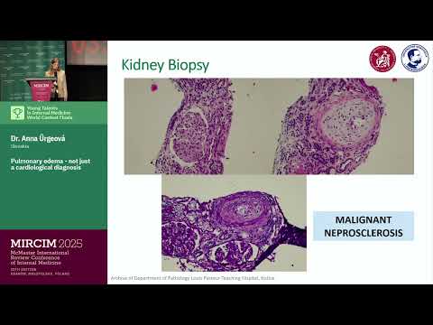 Pulmonary edema - not just a cardiological diagnosis