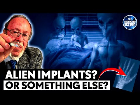 The Doctor Who Removed Alien Implants From Abductees