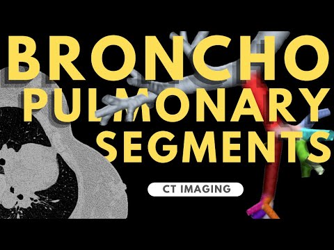 Segmental anatomy of the lung | Radiology anatomy part 1 prep | Bronchopulmonary segments on CT