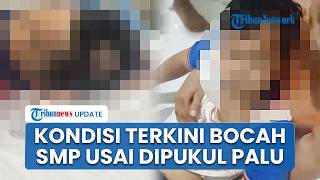 Kondisi Terkini Bocah SMP seusai Dipukul Palu oleh Temannya di Singkawang, Alami Cedera Saraf