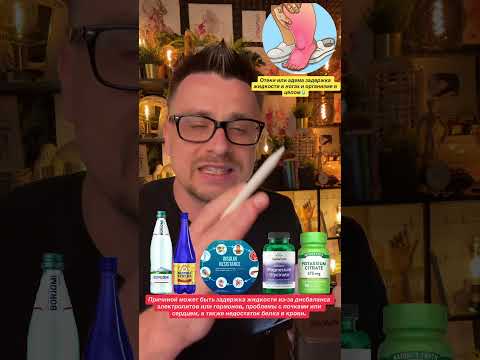 Отеки или адема задержка жидкости в ногах и организме в целом!