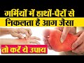 Summer में हाथों पैरों से निकलती है आग होत�