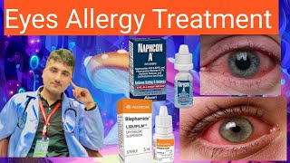 Eyes Allergy Treatment  /  Eyes Redness Treatment / Anti-Allergic  eye drops