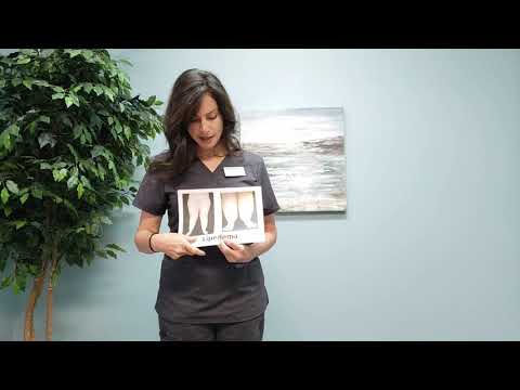 Lymphedema vs Lipedema: How to know the difference