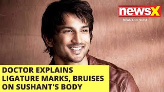 Doctor explains ligature marks, bruises on Sushant Singh Rajput's body | NewsX
