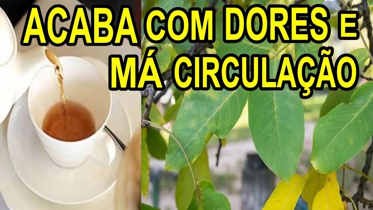 MÁ CIRCULAÇÃO, DOR NAS PERNAS, VARIZES E DORMÊNCIAS 💖 MARILENE SARAH FIALHO
