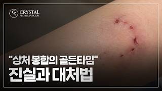 크리스탈성형외과 유튜브 영상