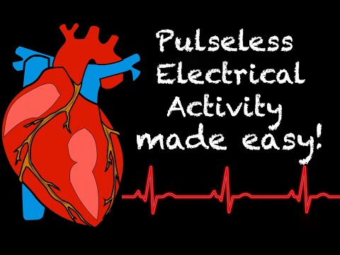EMS Cardiology || Tachy Tuesday: Pulseless Electrical Activity (PEA) in EMS