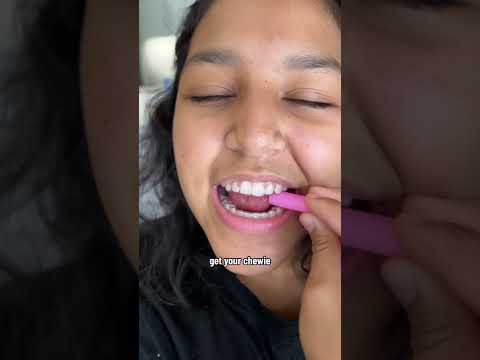 Tips for Retainer Pain