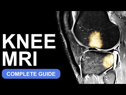 Knee MRI: The Ultimate Guide (Anatomy & What to Look For)