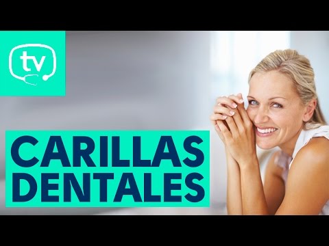 Las carillas dentales