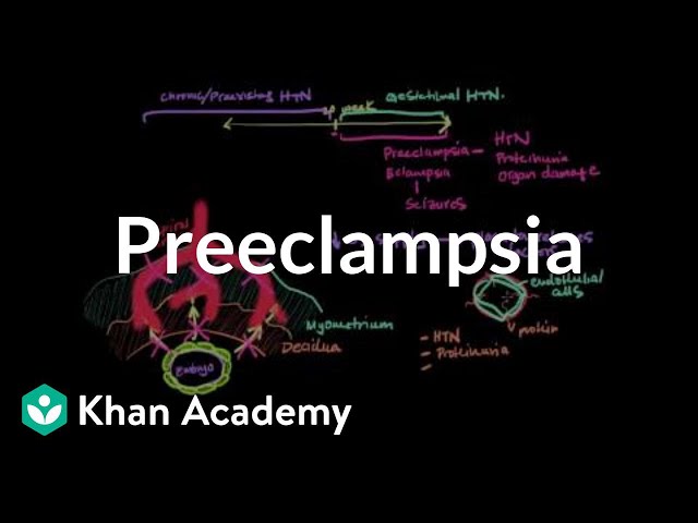 Wymowa wideo od preeclampsia na Angielski