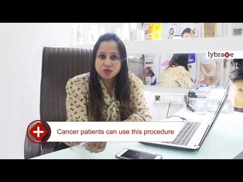 What is Non Surgical Hair Replacement System?