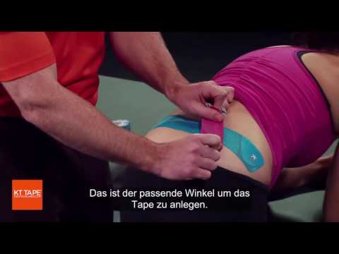 Fingergelenkimplantat Verletzte ich diprospan Lötstelle