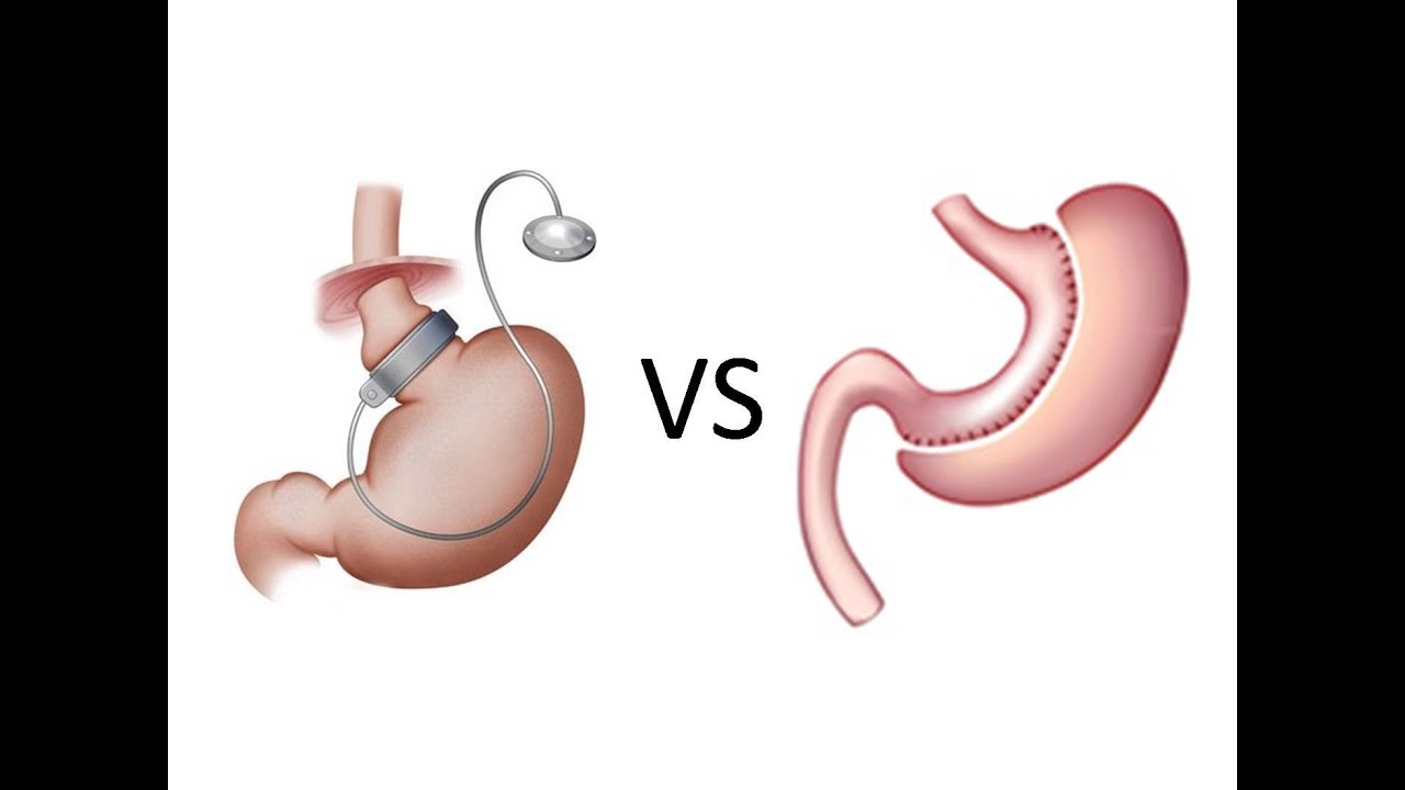 Alberto Gómez Meléndez-21