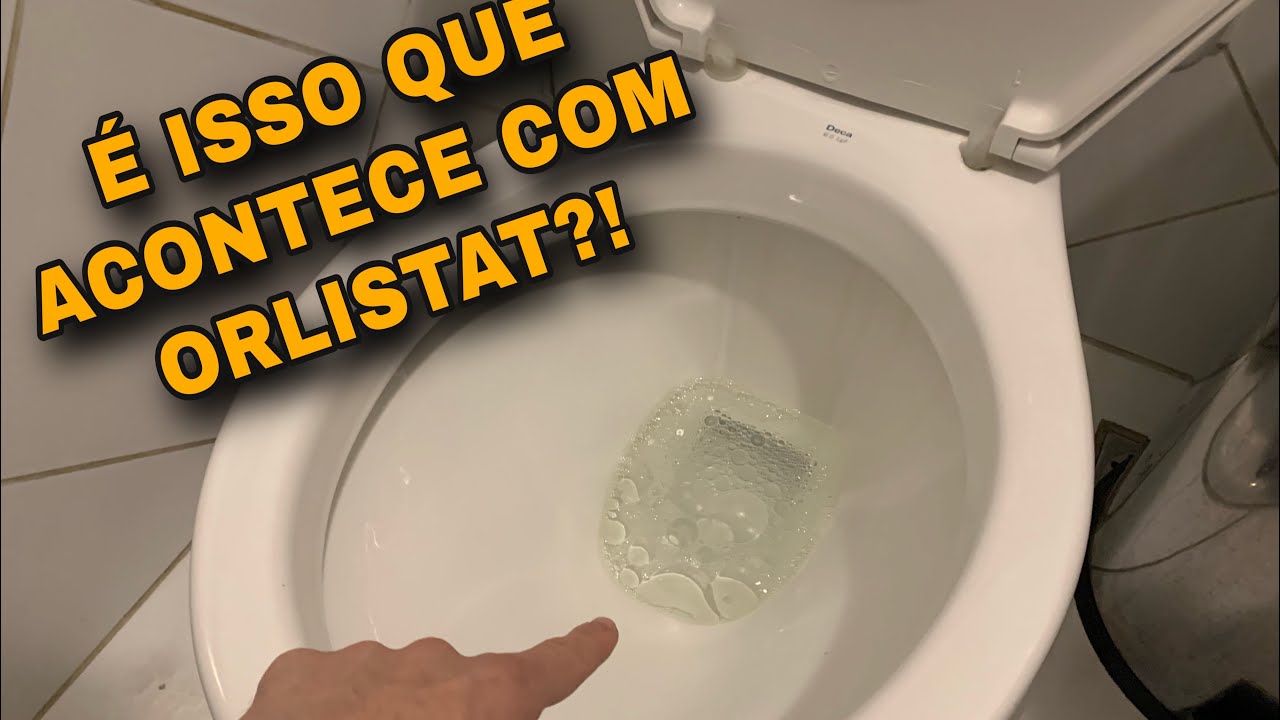 Orlistat - Side effects