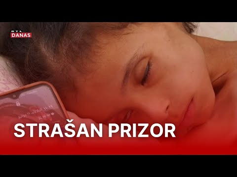 Ova djevojčica možda neće preživjeti, njezina mama: 'Stanje se dodatno pogoršalo' | RTL Danas