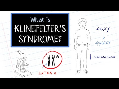 What is Klinefelter's Syndrome?
