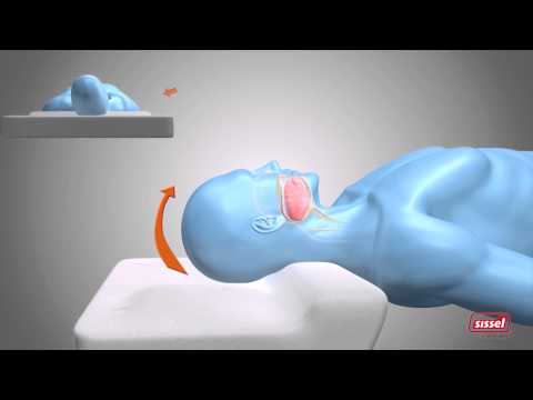 AntiSchnarch-Kissen SISSEL Silencum - reduziert schnarchen sofort