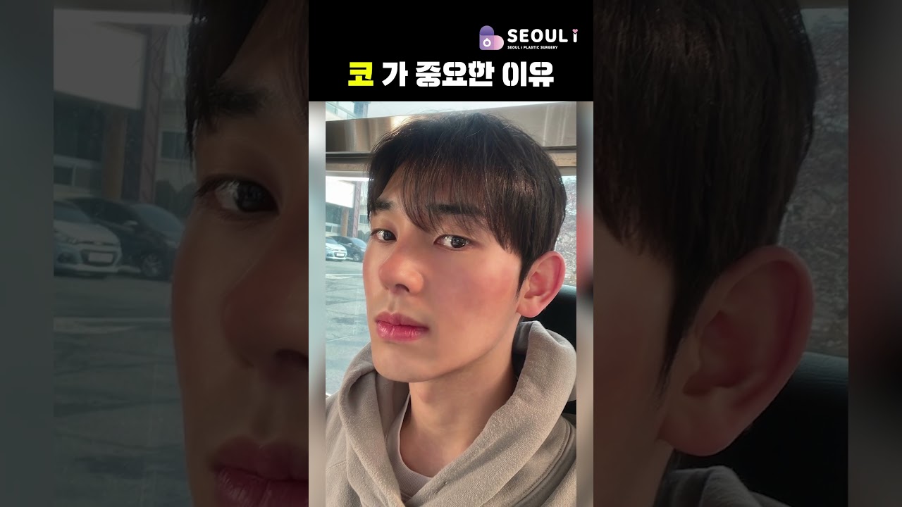 코수술(매부리,코끝,복코) 후기 #shorts