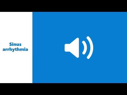 Sinus arrhythmia murmur