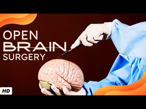 All About Allergy Shots