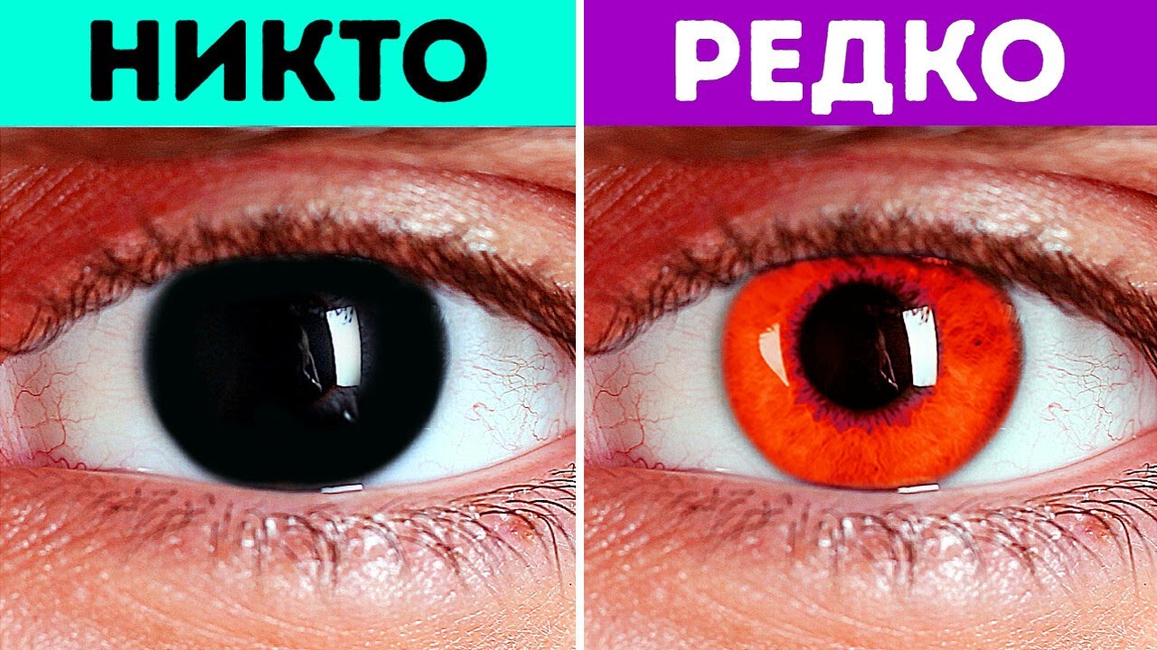 Почему у людей почти не бывает фиолетовых глаз? И ещё факты о теле, которые ва