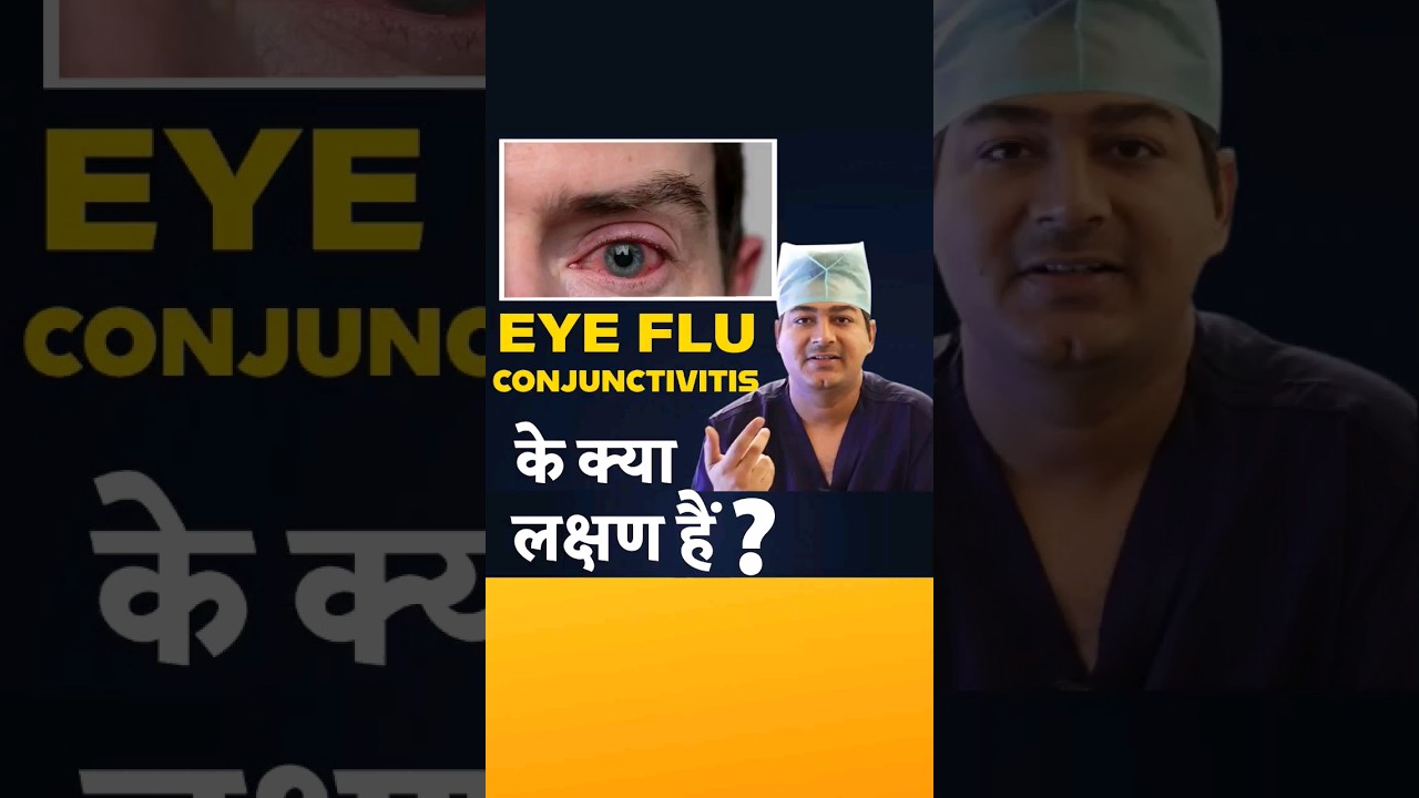 Watch How Eye Flu Occur videos How Eye Flu Occur