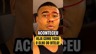 BITELO REVELA O QUE ACONTECEU COM SEU OLHO APÓS BATER O RECORDE DOS 400KG NO LEVANTAMENTO TERRA!