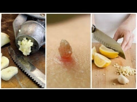 Powiększyć penisa w domu za darmo Bardzo mały penis w kontakcie