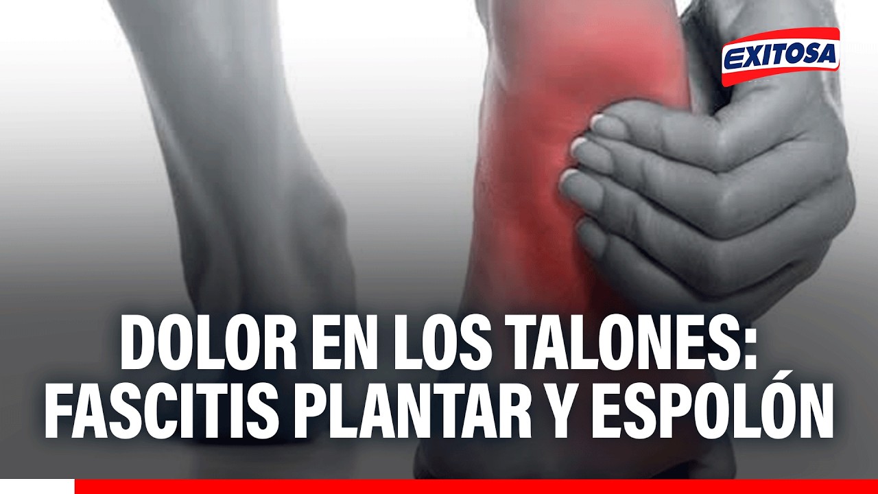 🔴🔵 Dolor en los talones: Fascitis plantar y espolón