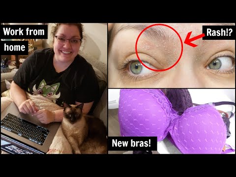 VLOGMAS 2023 (Days 1 & 2) | Mystery Rash, Bra Haul, Working From Home & MORE!!!