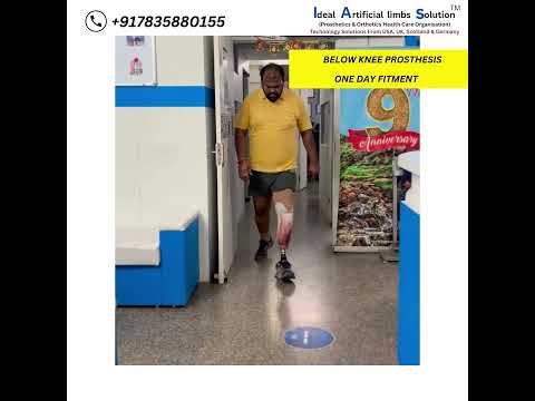 Passive prosthetic silicone foot prosthesis, below the knee,...