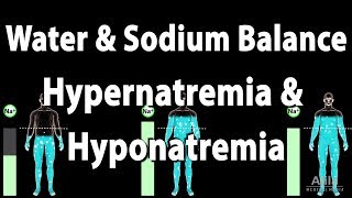 Water and Sodium Balance, Hypernatremia and Hyponatremia, Animation