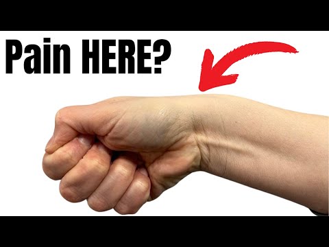 CMC Arthritis vs Dequervain s