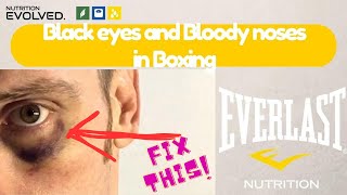 🚑Boxing Injury Management: Black Eye & Bloody Nose Treatment | Expert First Aid Tips🥊