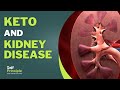 The link between Keto and Kidney Disease.