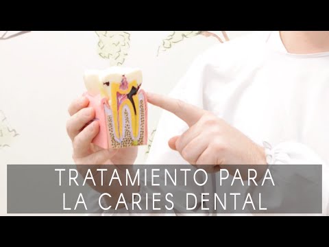 Tratamiento para la caries dental