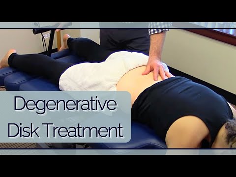 Gelenkschmerzen Osteosklerose kleine Gelenke