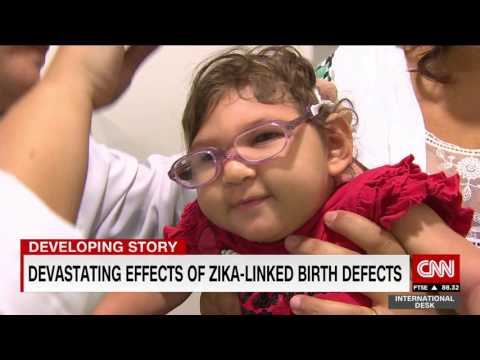 Ground zero of the Zika virus - a look at the babies most affected