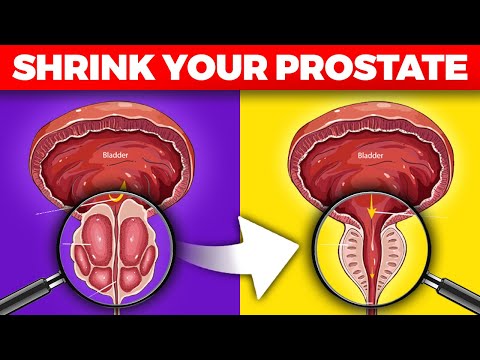 , title : 'The #1 Important Nutrient to Shrink Your Prostate'