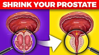 How to Shrink Your Prostate Naturally: The #1 Nutrient You Need