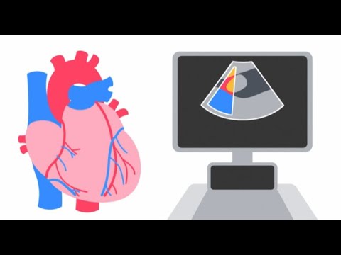 Understanding an Echocardiogram