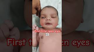 First time open eyes and safe feeling get well soon bachcha ❤️‍🩹🙏👍#meditation #nicu #knowledgeable