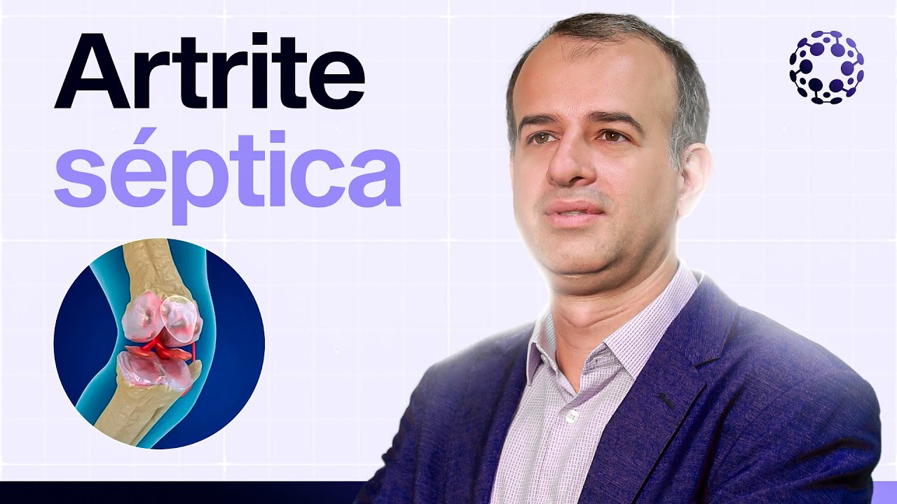 Artrite séptica