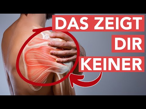 Scapula alata - cause + solution with these 3 exercises