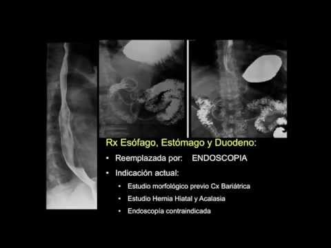 Como medir el indice cardiotoracico